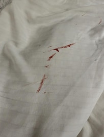 Blood or something on the underside of the bed sheets