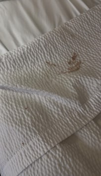 You can see the blood stains