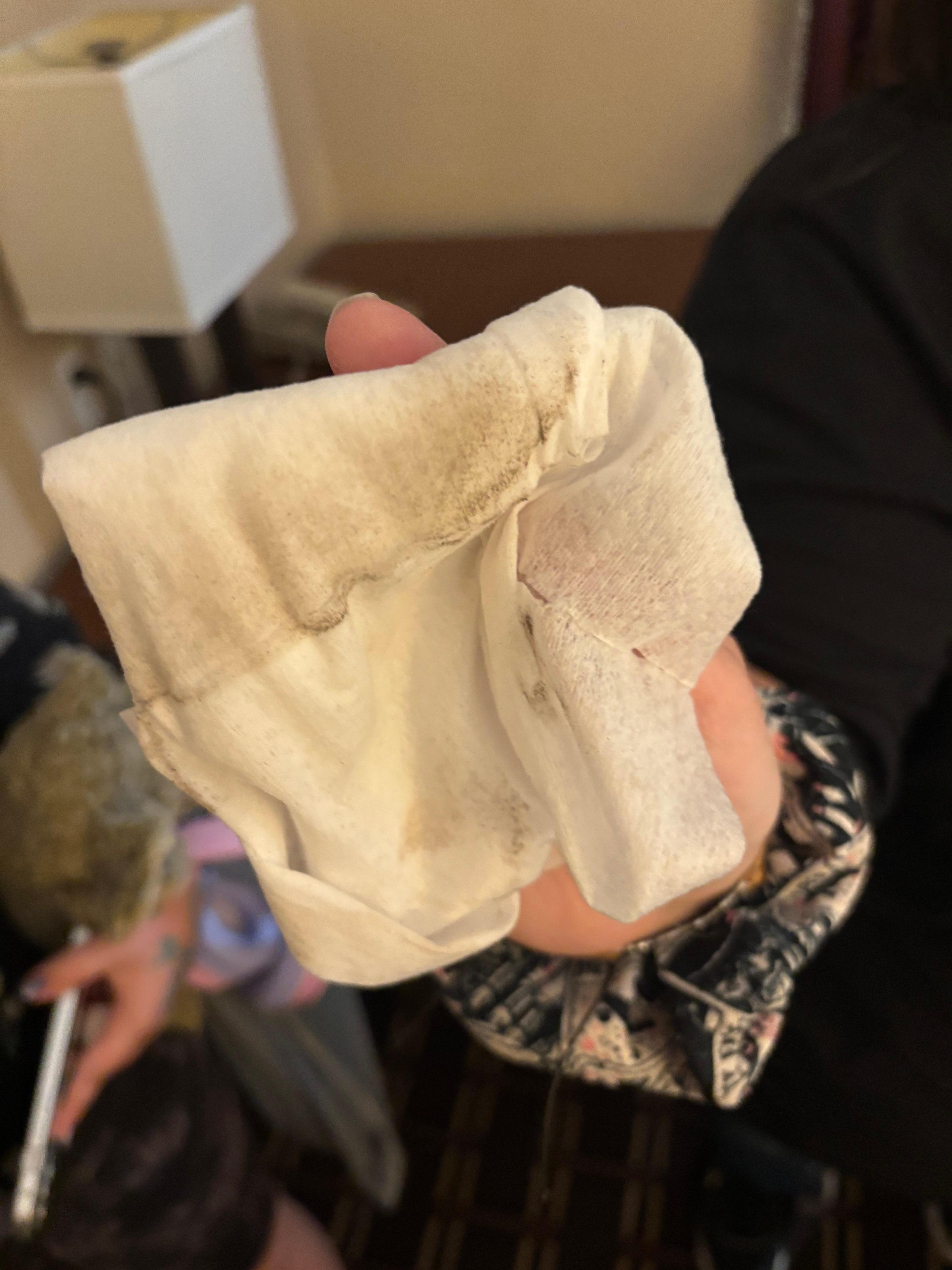 This was just after 1 swipe with a disinfectant towel