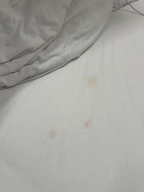 Stains on the sheet