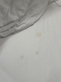 Stains on the sheet