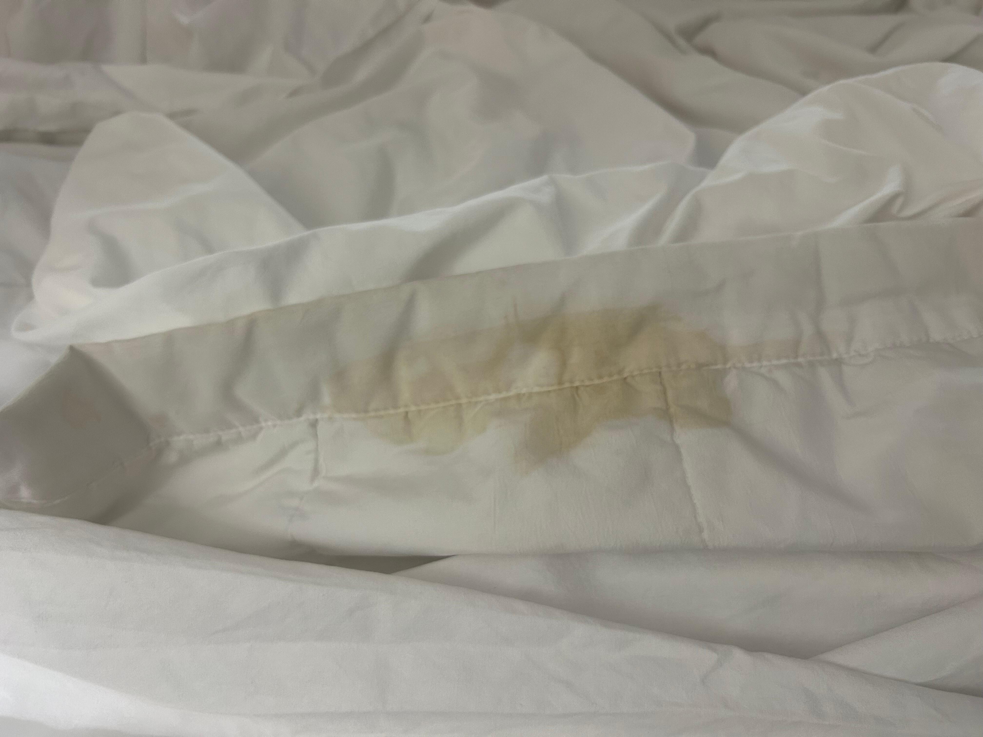 Yellow ugly stains on the comforter and dirt rings on the fringe of the comforter 