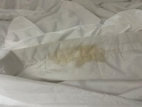 Yellow ugly stains on the comforter and dirt rings on the fringe of the comforter