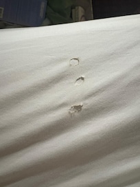 Burns in sheets