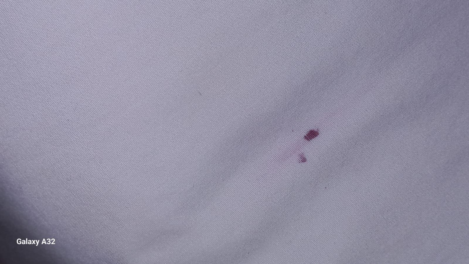 Mancha de sangre en la sabana