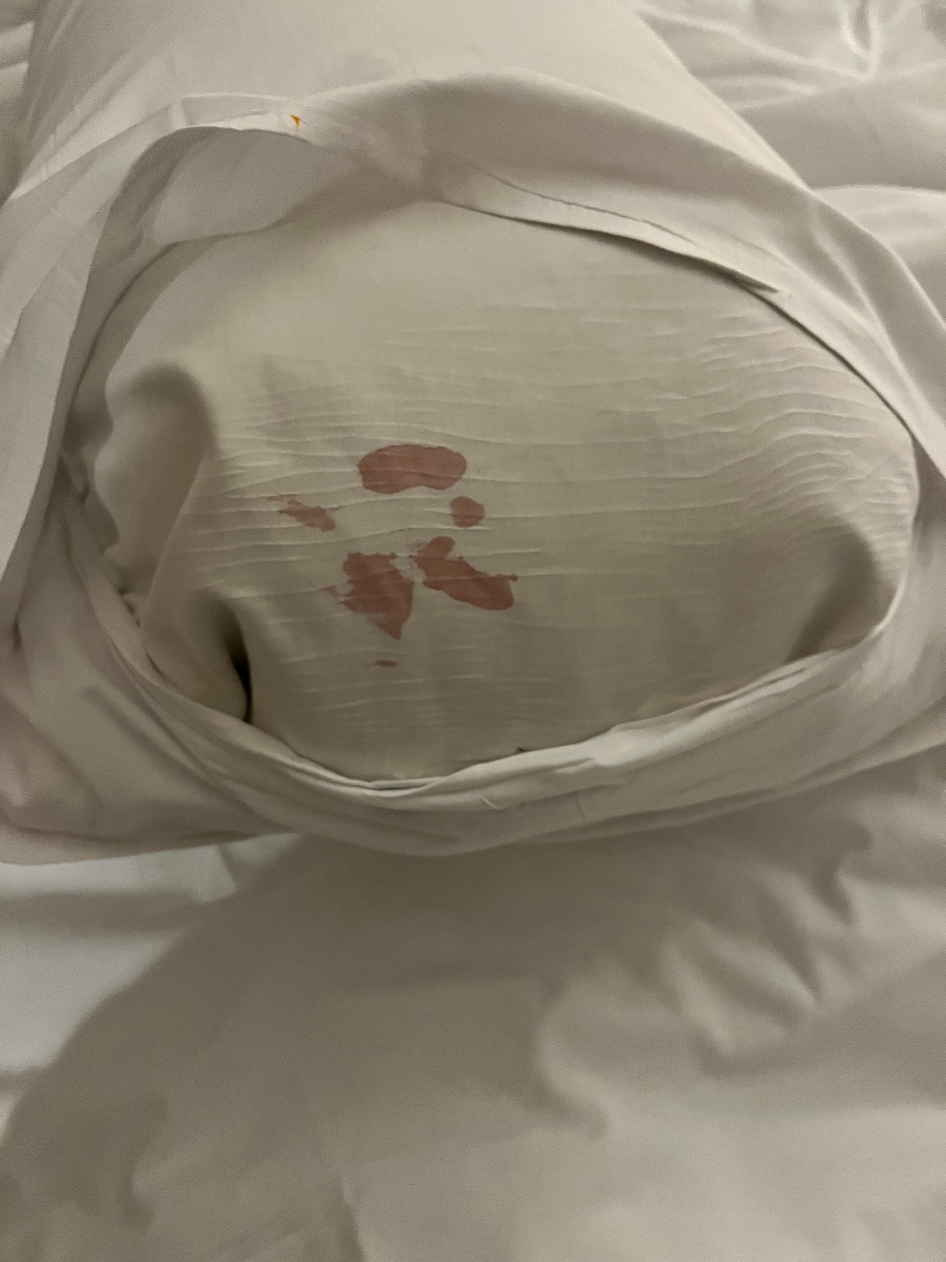 Blood stains on pillow 