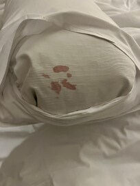 Blood stains on pillow