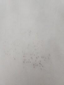 Mold on my sheets