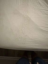 Stains in sheets