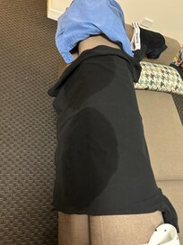 Water stains from ceiling