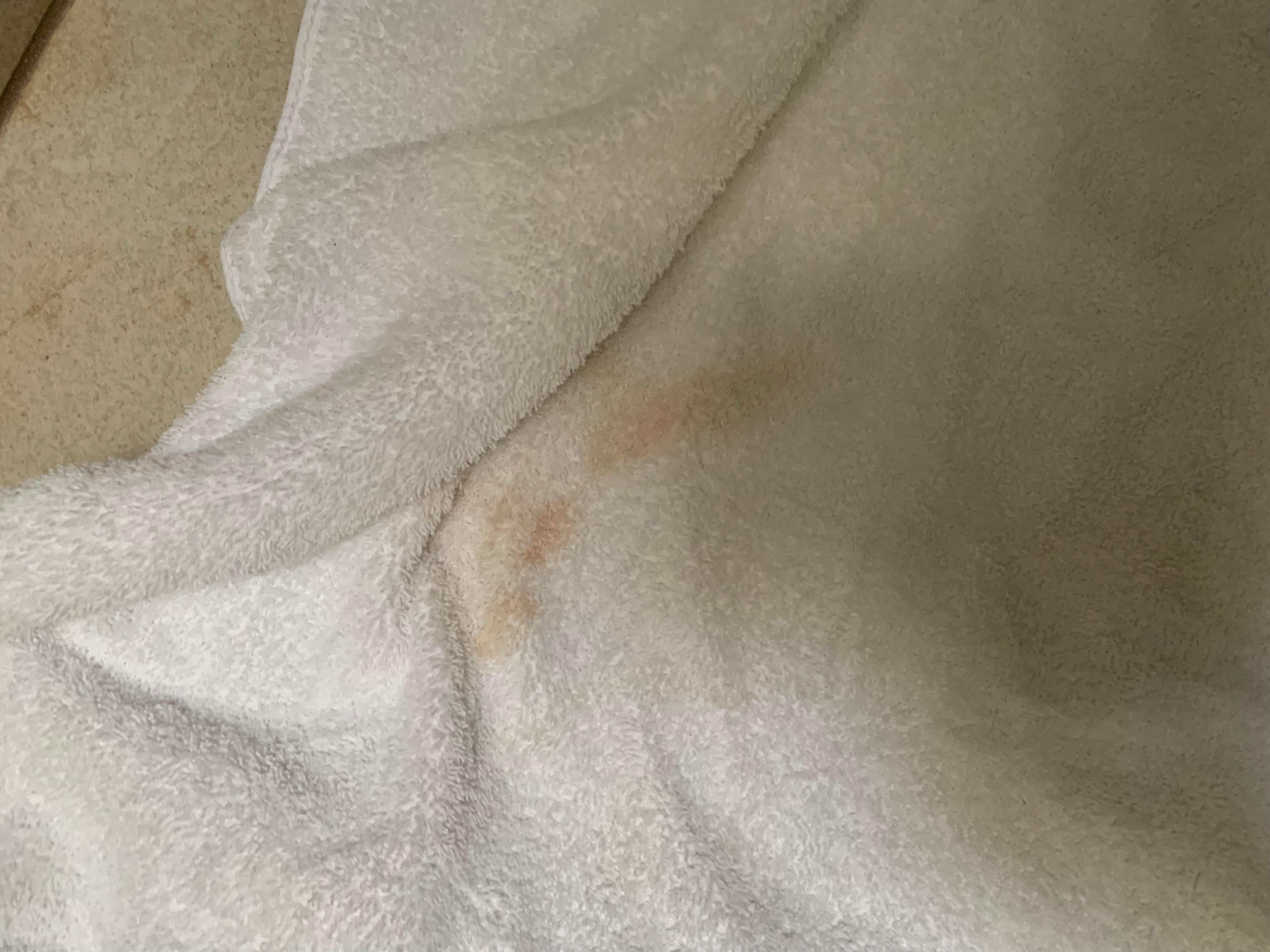 blood on towel?