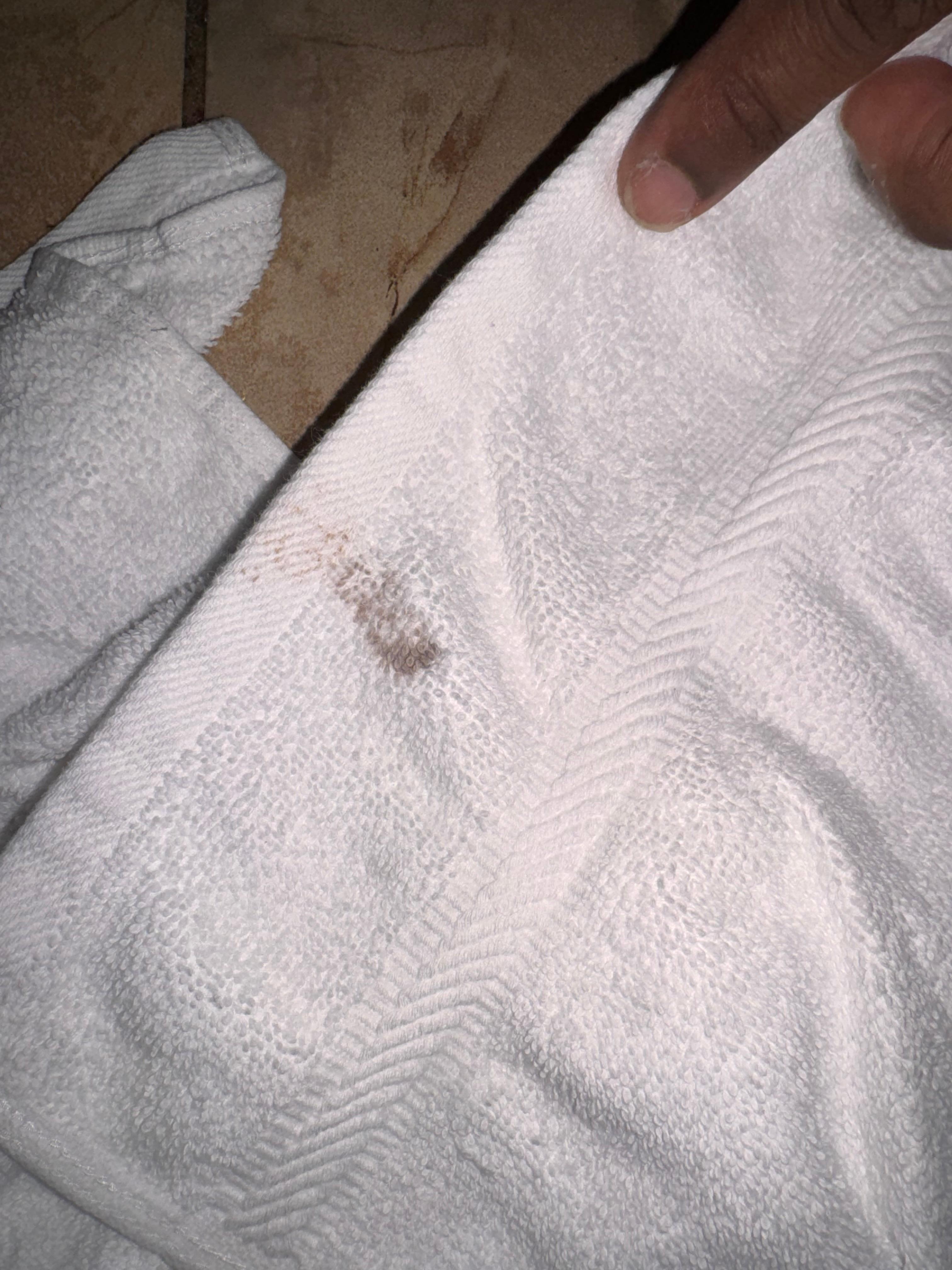 Dirty and stained towels 