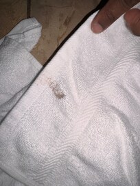 Dirty and stained towels