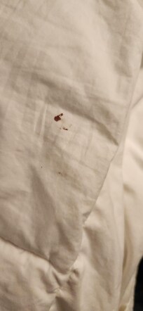 Blood on comforter