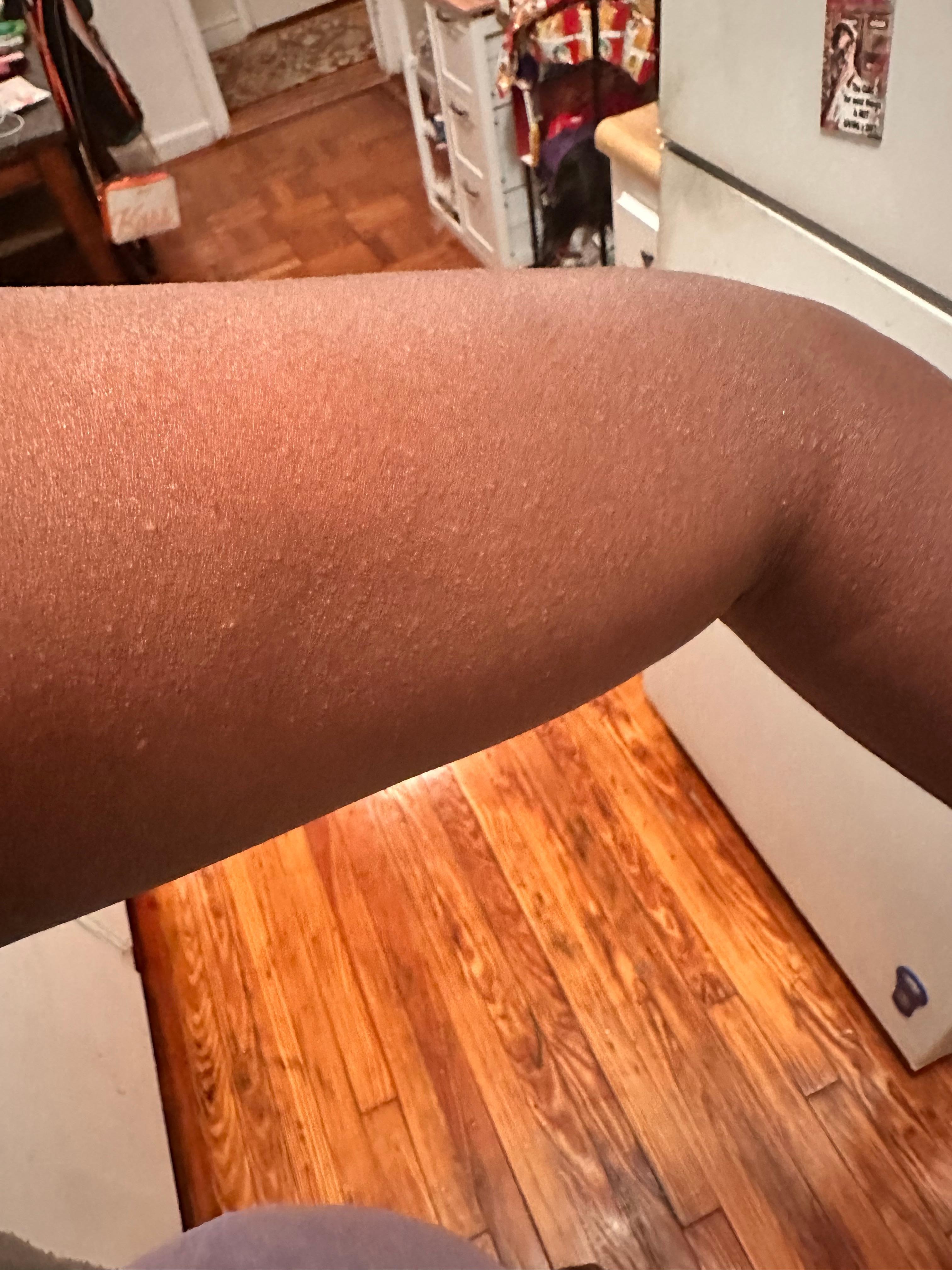 Rashes from the uncleaned sheets