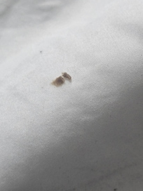 Nasty stuff stuck to the pillow.