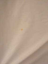 Stain on pillow case