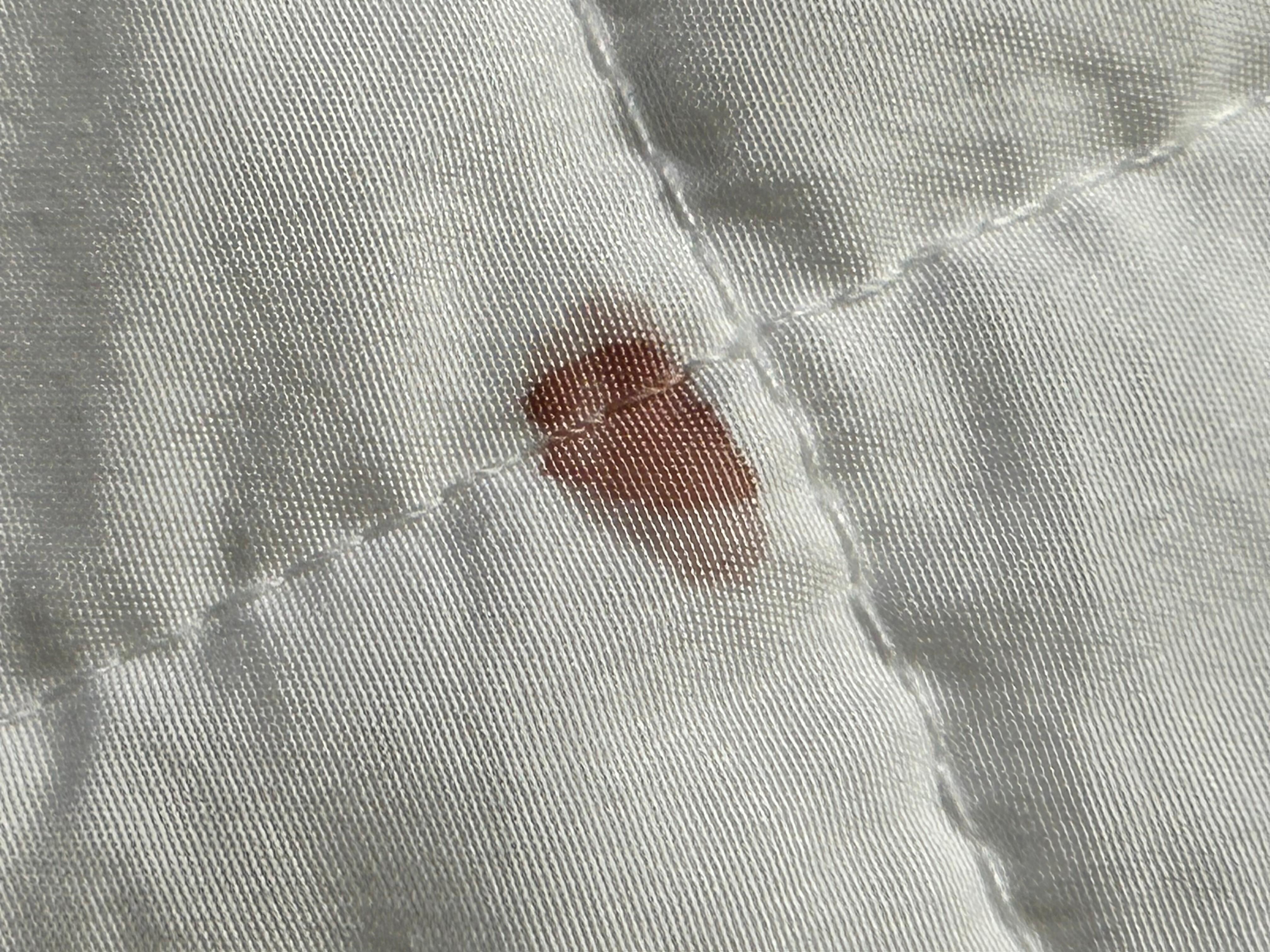 Blood on blanket.