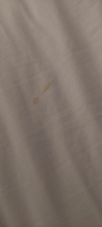 is that blood? sheets were stained