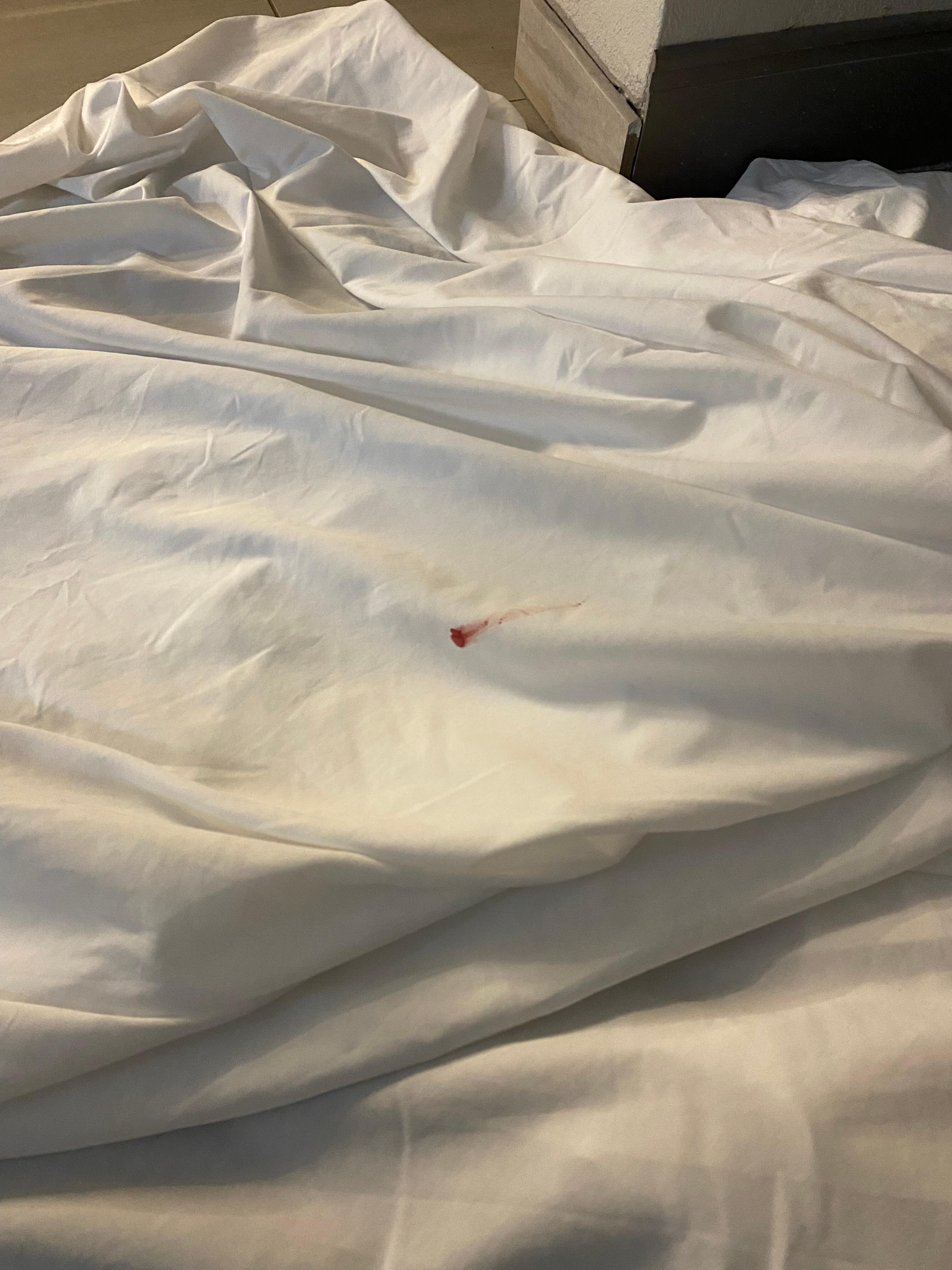 Blood on flat sheet