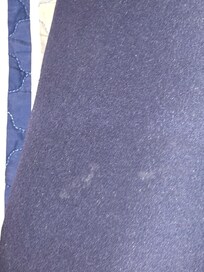 Stains on pillowcases