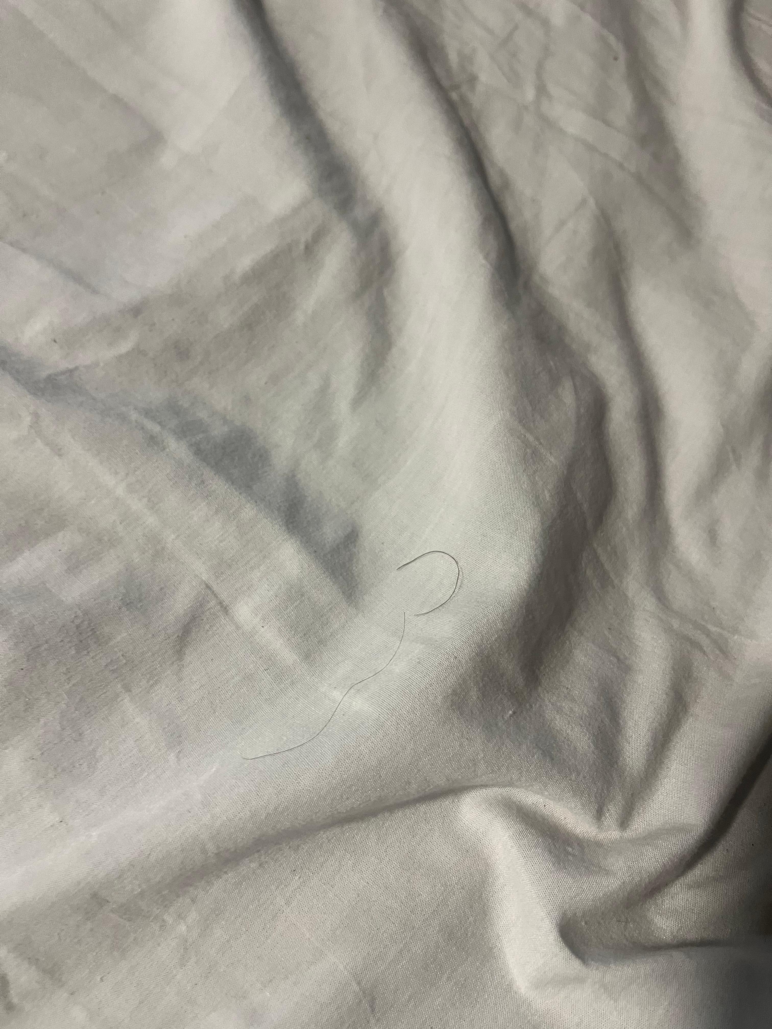 Hair on bed, could be a pubic hair can’t tell for sure. 