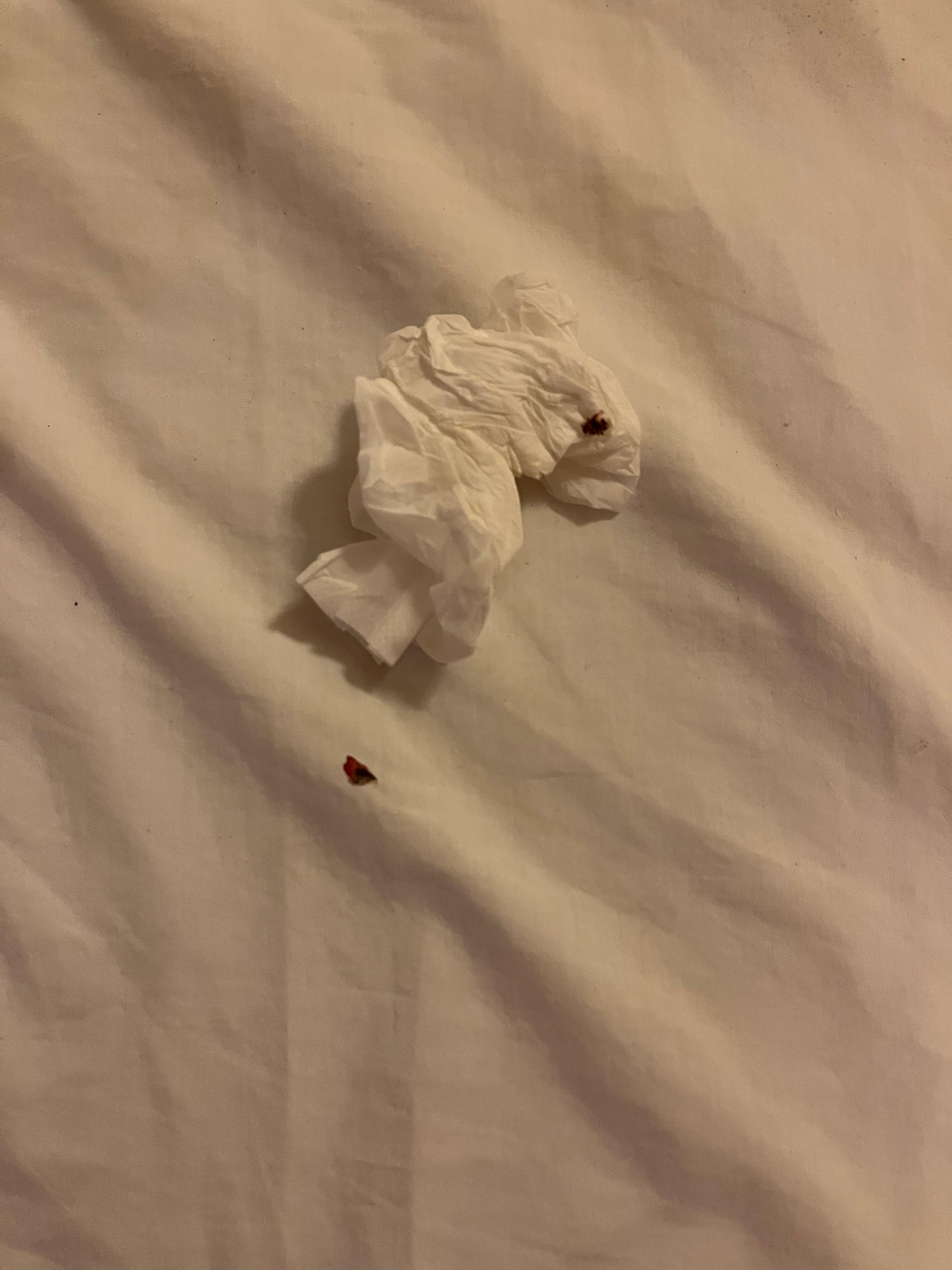 Esta fue la chinche más grande ¡uff, terrible! 