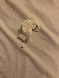 Esta fue la chinche más grande ¡uff, terrible!