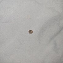 Bug skins found after stay as well. 😒🤢🤮