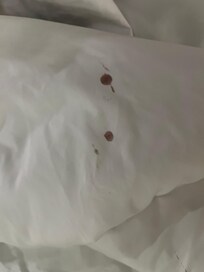 Not what you want to see when you turn down the sheets for bed.