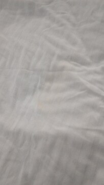 Yellow stain on sheet