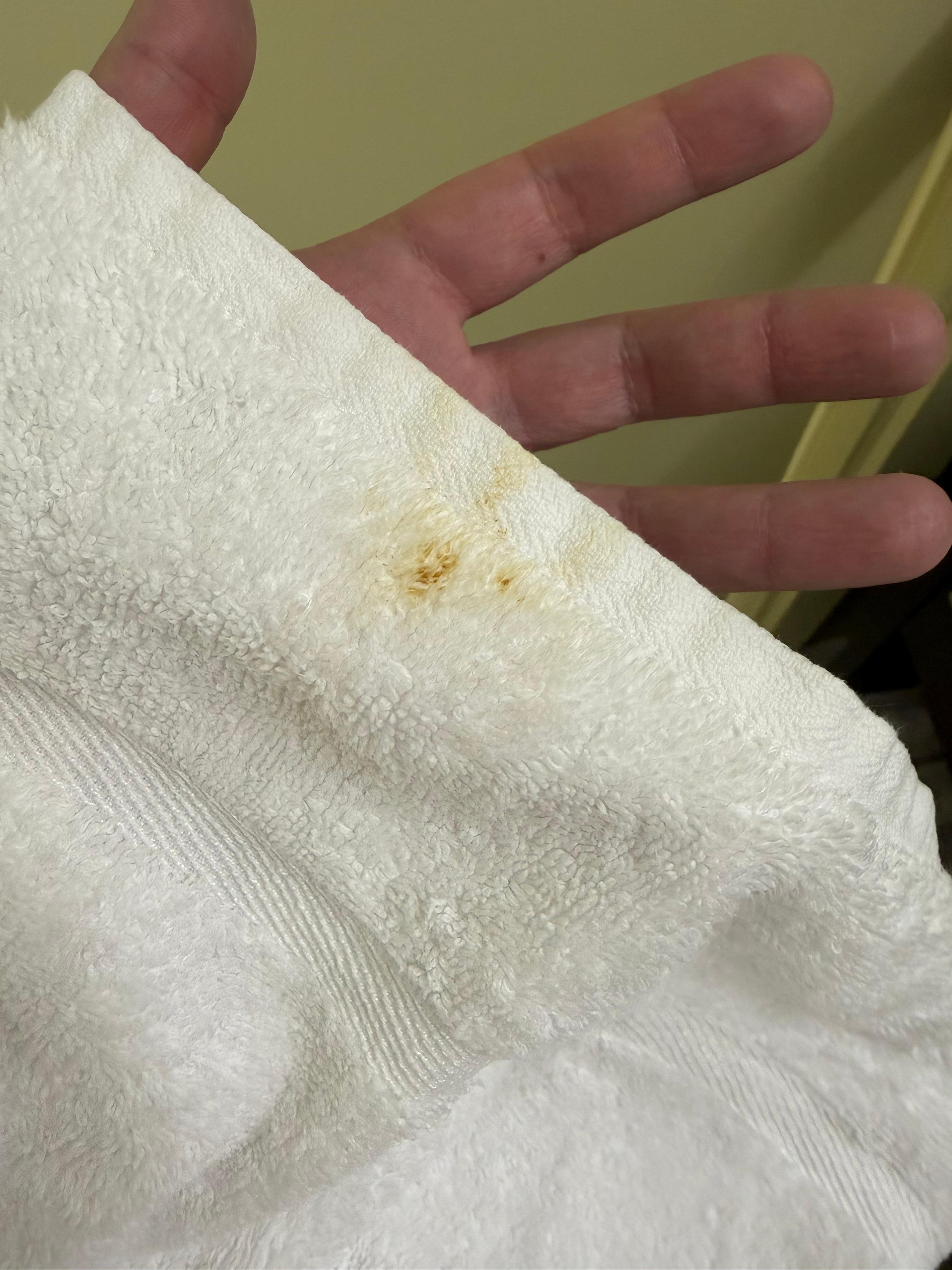The stain on the towel my wife grabbed after her shower which made her feel dirty after getting clean because she questioned if the towel was dirty.