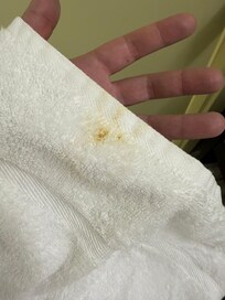 The stain on the towel my wife grabbed after her shower which made her feel dirty after getting clean because she questioned if the towel was dirty.
