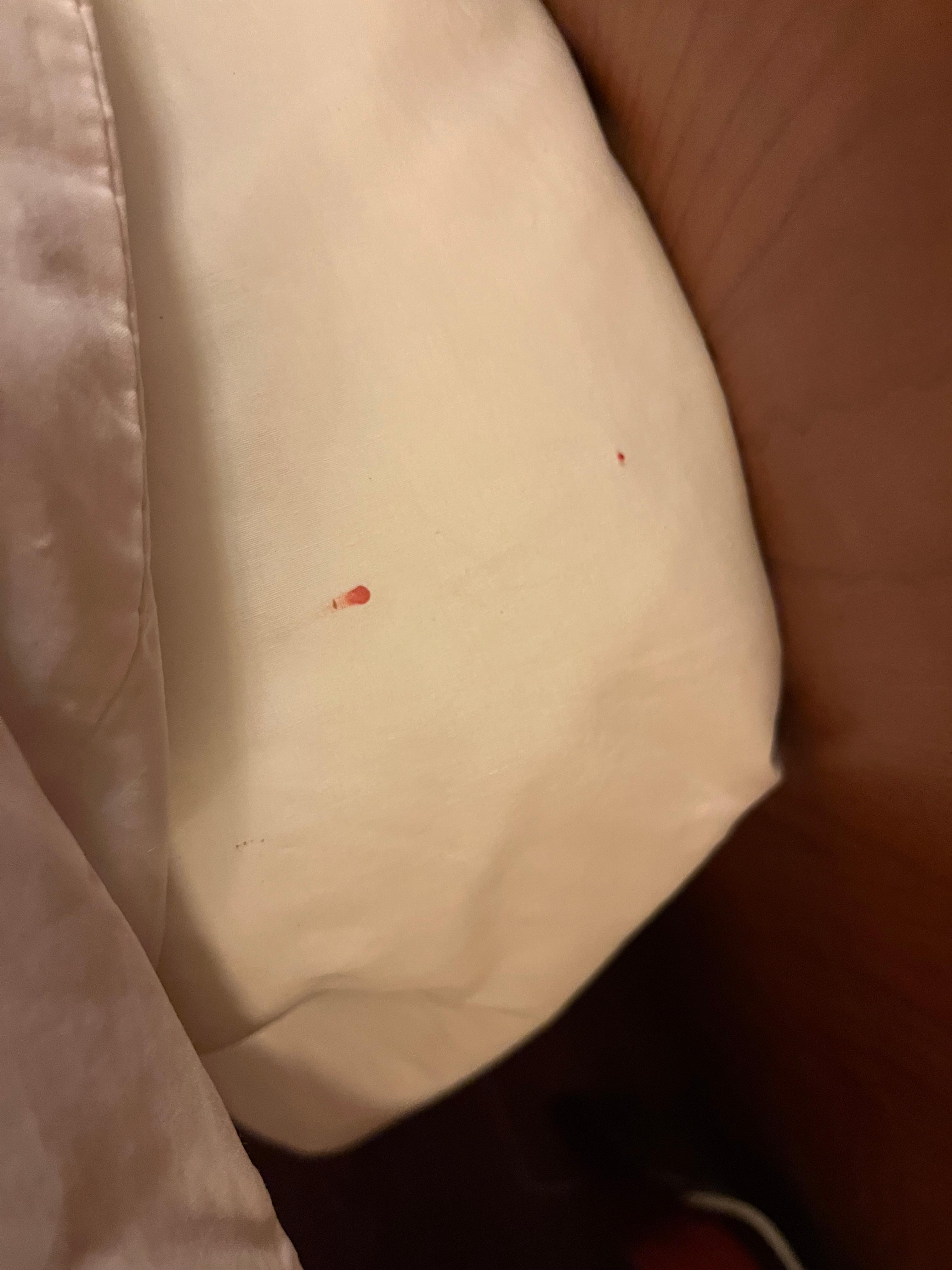 Aplastamos a los insectos y dejaban rastros de sangre 