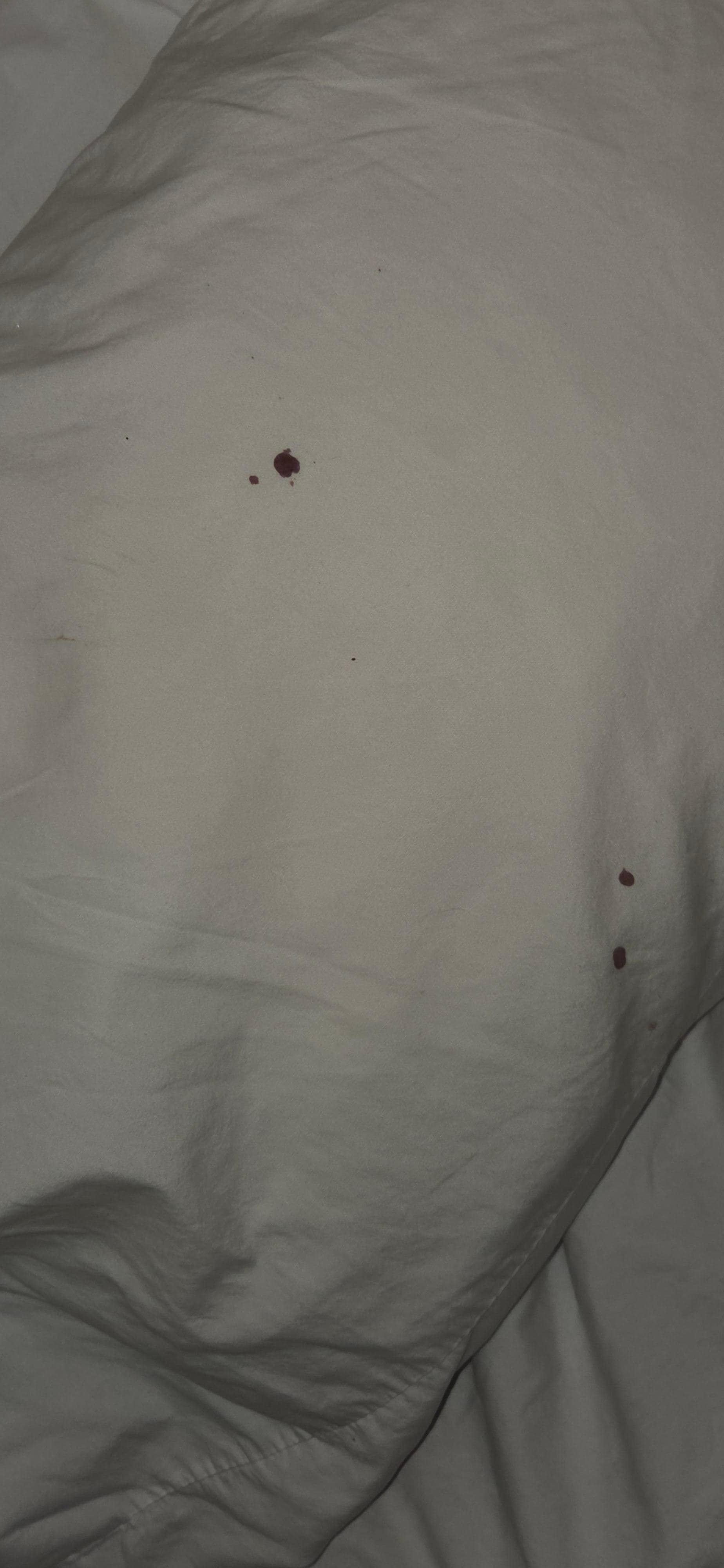 Bloody pillow 