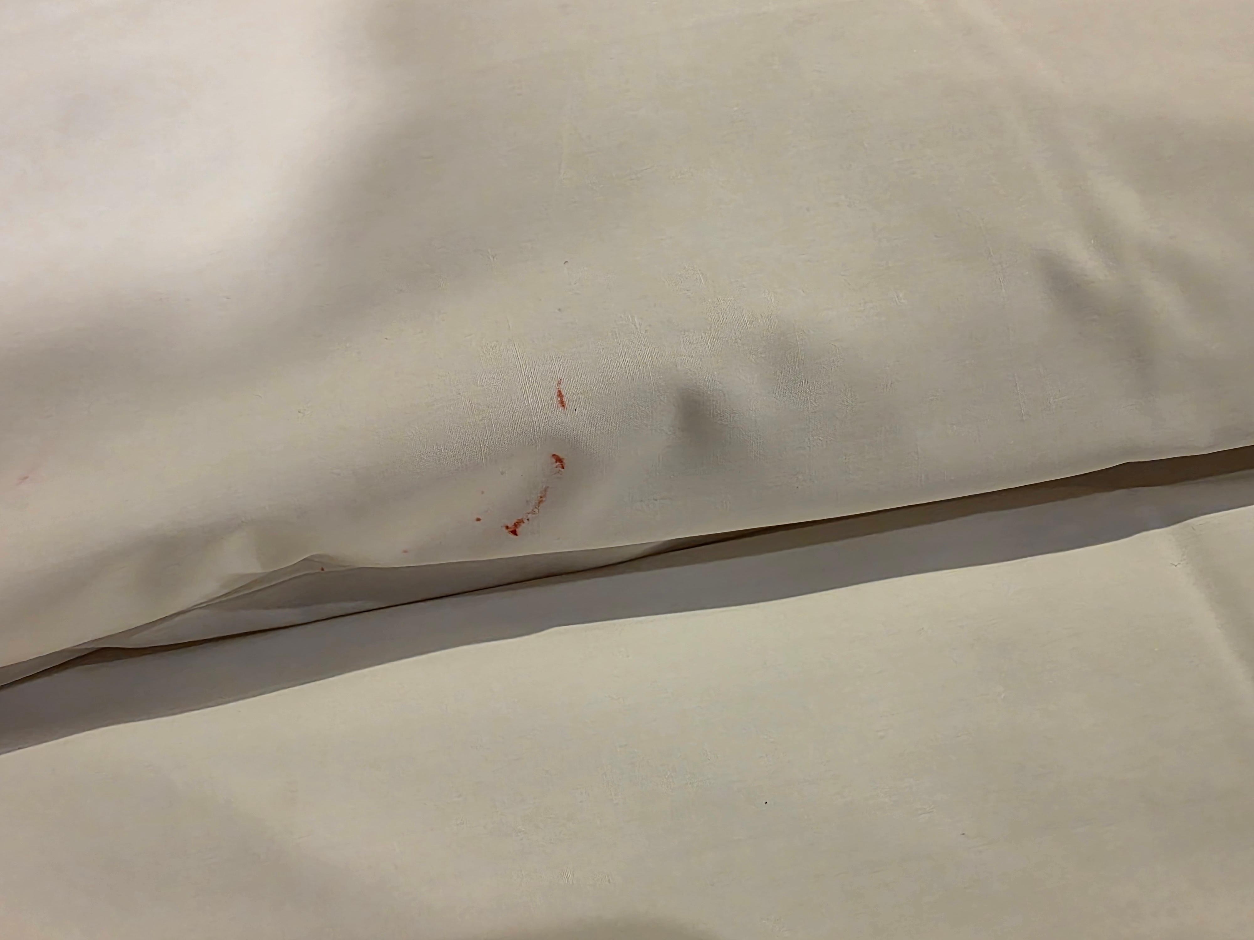 혈흔은지 볼펜자국인지 알수없지만 보기 불편했습니다