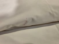 혈흔은지 볼펜자국인지 알수없지만 보기 불편했습니다