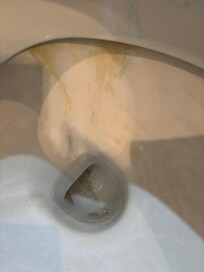 Pan of toilet, along with stains on the rim