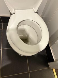 Moving toilet seat catching skin