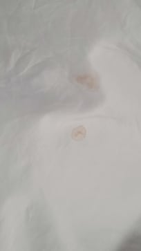 Blood on the pillowcases