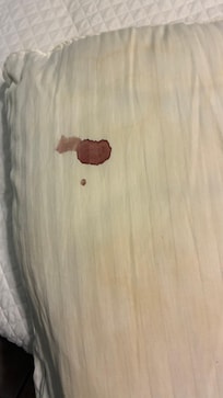 Blood stains on the pillow cases