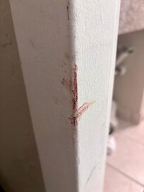 Not sure if this is blood or not