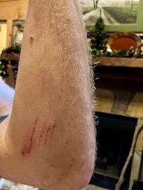 This is one of the injuries when I slipped.