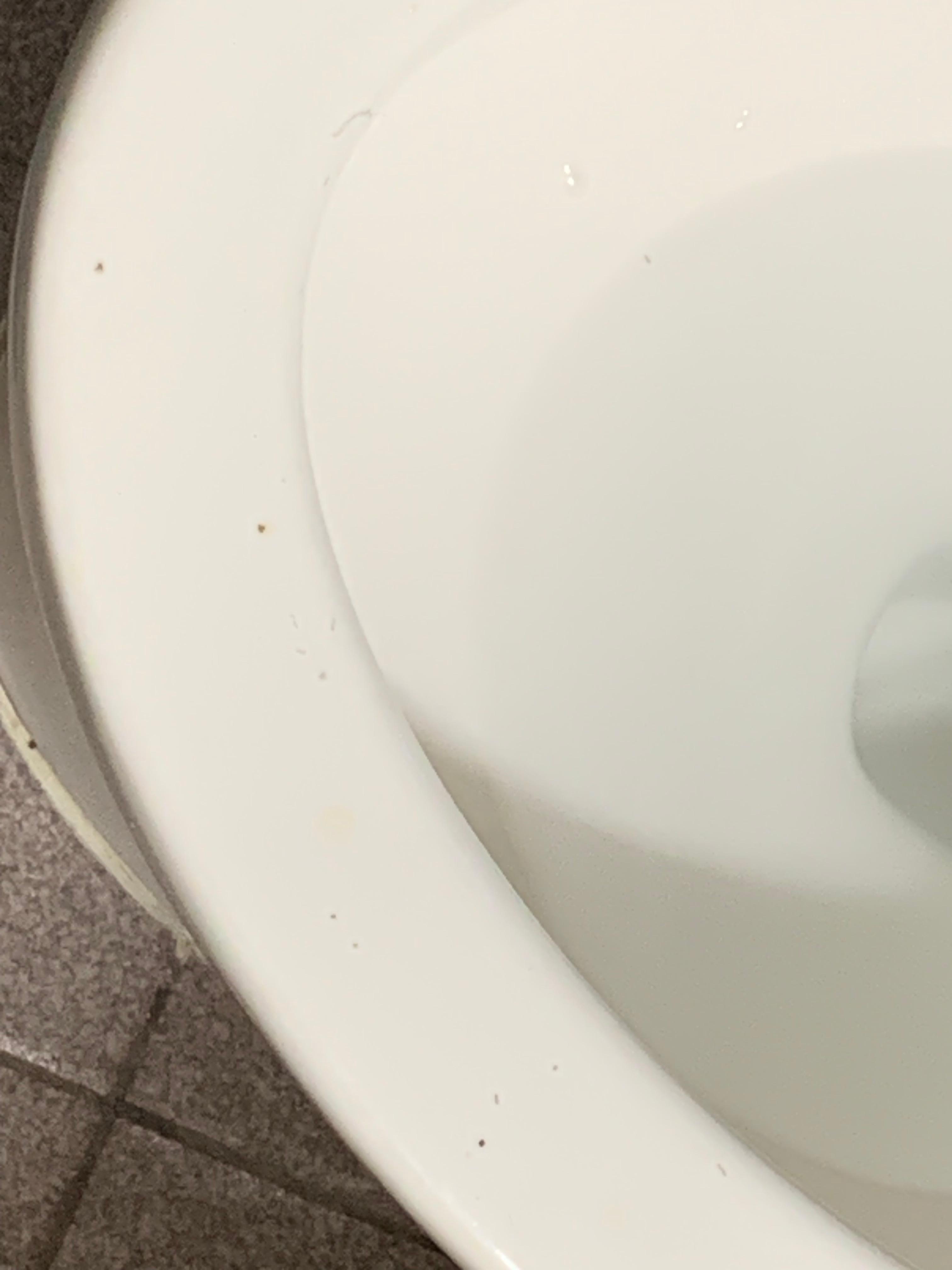 Toilet with Feces, hair, and dirt. 