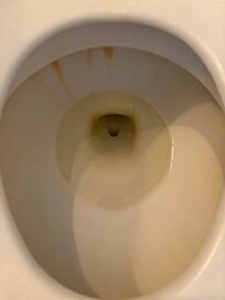 dirty toilet