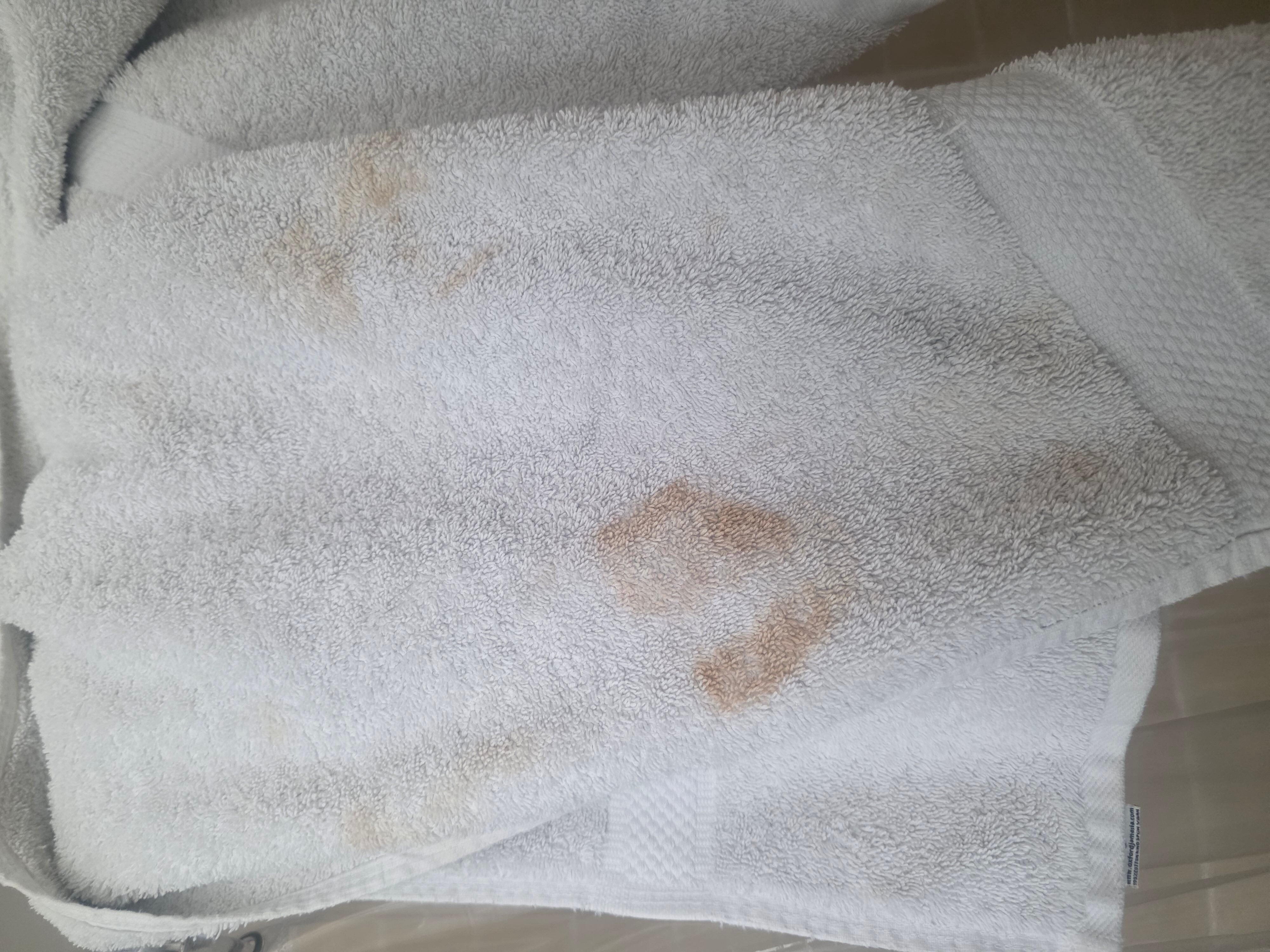 These are the towels I was giving to use, with stains all over.
It discussed.
