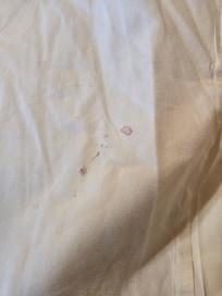 blood on pillow case