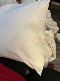 Unclean pillow case