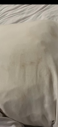 Spots/ stains on sheets and pillows
