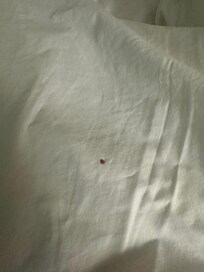 Blood on sheet